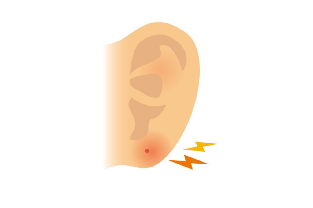 腫れている耳のイラスト